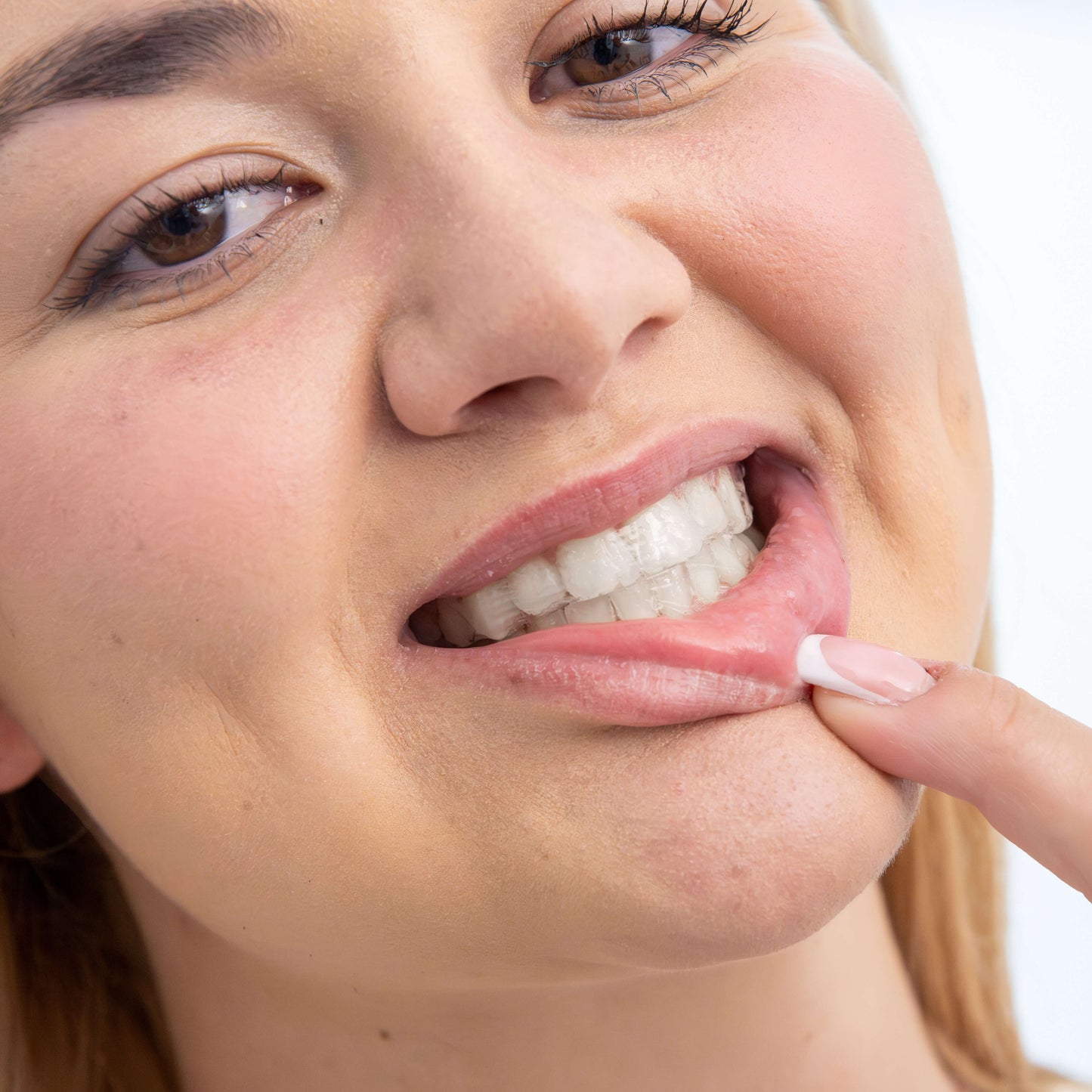BoldSmile Whitening Strips
