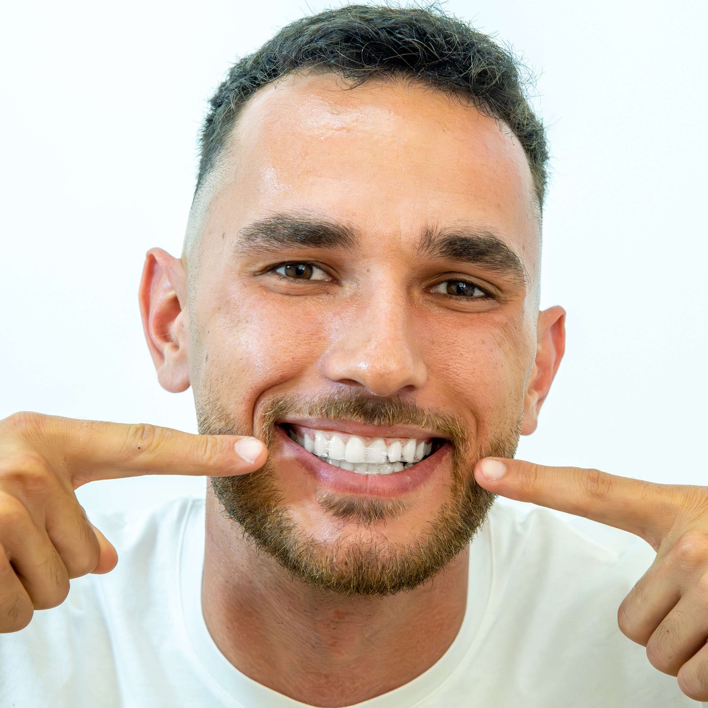 BoldSmile Whitening Strips